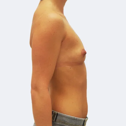 Image before