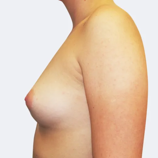 Image before