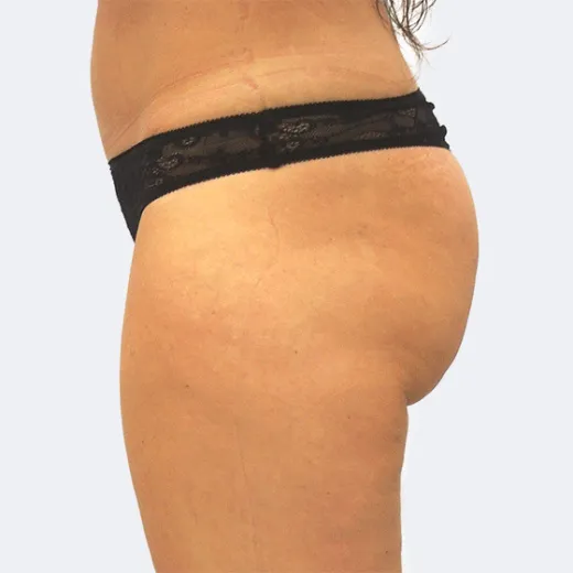 Image before