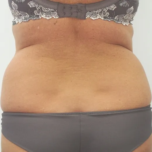 Image before