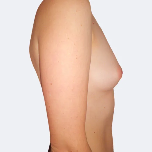 Image before