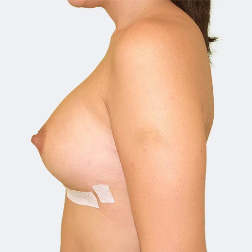 Image after