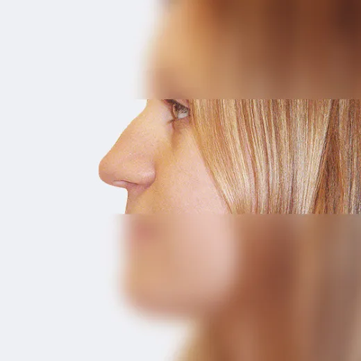 Image before