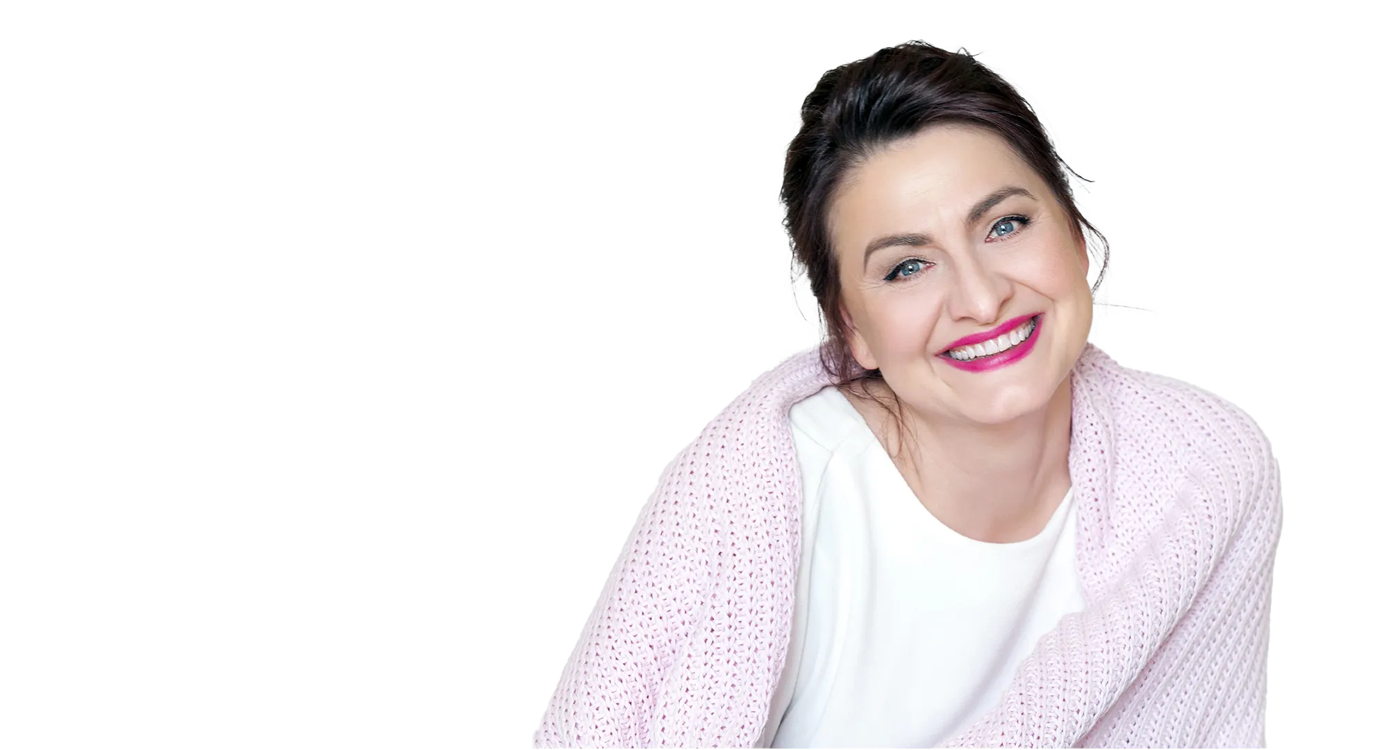 Mrs Monika 46 - Minilift and eyelid surgery