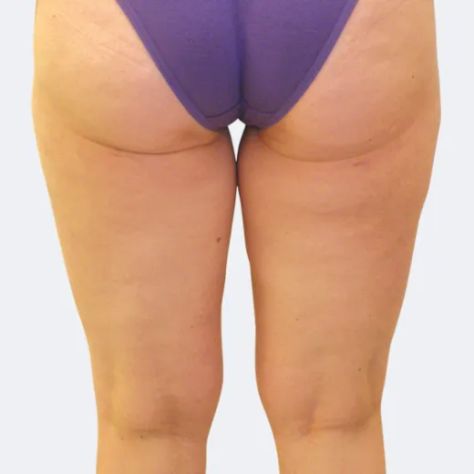 Image before